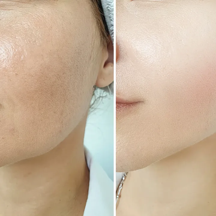 Deep Anti-Aging Effect Img